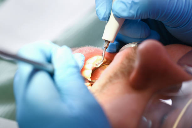 Best Emergency Wisdom Teeth Removal in Metropolis, IL
